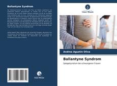 Couverture de Ballantyne Syndrom