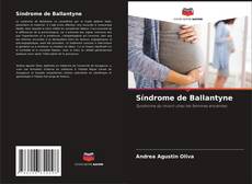 Síndrome de Ballantyne kitap kapağı