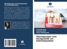 Bookcover of Überlegungen zum Hartgewebe um Zahnimplantate