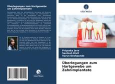 Portada del libro de Überlegungen zum Hartgewebe um Zahnimplantate