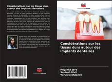 Buchcover von Considérations sur les tissus durs autour des implants dentaires