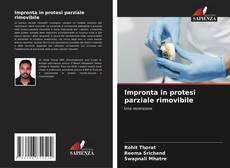 Bookcover of Impronta in protesi parziale rimovibile