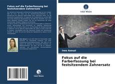 Bookcover of Fokus auf die Farberfassung bei festsitzendem Zahnersatz