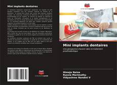 Copertina di Mini implants dentaires