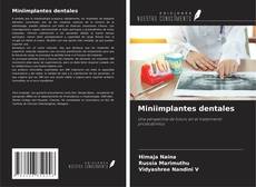 Miniimplantes dentales kitap kapağı