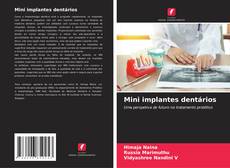 Buchcover von Mini implantes dentários