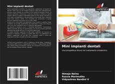 Bookcover of Mini impianti dentali