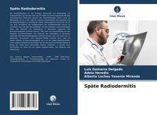 Buchcover von Späte Radiodermitis