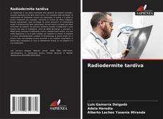 Borítókép a  Radiodermite tardiva - hoz