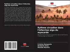 Buchcover von Rythme circadien dans l'infarctus aigu du myocarde