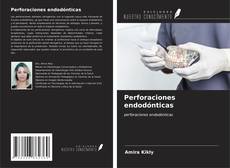 Bookcover of Perforaciones endodónticas
