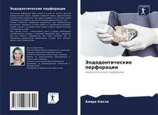 Capa do livro de Эндодонтические перфорации 
