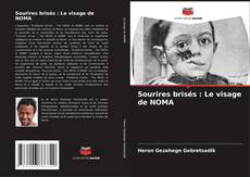 Sourires brisés : Le visage de NOMA kitap kapağı