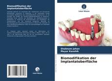 Biomodifikation der Implantatoberfläche kitap kapağı