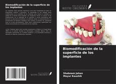 Copertina di Biomodificación de la superficie de los implantes