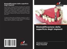 Copertina di Biomodificazione della superficie degli impianti