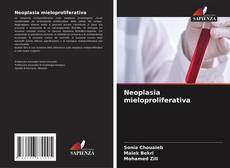 Copertina di Neoplasia mieloproliferativa