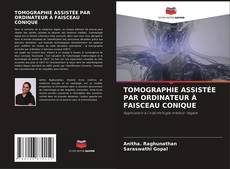 Bookcover of TOMOGRAPHIE ASSISTÉE PAR ORDINATEUR À FAISCEAU CONIQUE