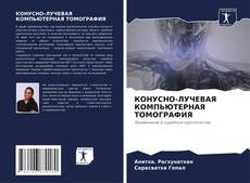 Portada del libro de КОНУСНО-ЛУЧЕВАЯ КОМПЬЮТЕРНАЯ ТОМОГРАФИЯ