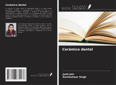 Bookcover of Cerámica dental
