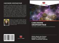 CARCINOME OROPHARYNGÉ的封面