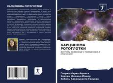 Bookcover of КАРЦИНОМА РОТОГЛОТКИ
