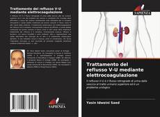 Bookcover of Trattamento del reflusso V-U mediante elettrocoagulazione