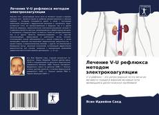 Capa do livro de Лечение V-U рефлюкса методом электрокоагуляции 