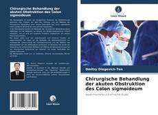 Chirurgische Behandlung der akuten Obstruktion des Colon sigmoideum的封面