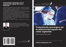 Buchcover von Tratamiento quirúrgico de la obstrucción aguda del colon sigmoide