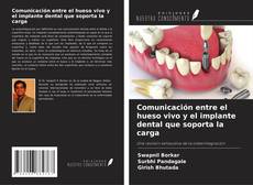 Portada del libro de Comunicación entre el hueso vivo y el implante dental que soporta la carga