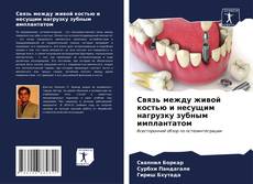 Bookcover of Связь между живой костью и несущим нагрузку зубным имплантатом