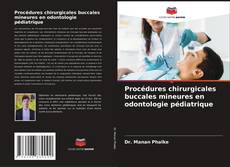 Procédures chirurgicales buccales mineures en odontologie pédiatrique kitap kapağı