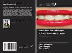 Buchcover von Reemplazo del incisivo por prótesis implantosoportada