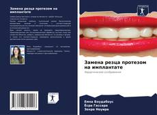 Borítókép a  Замена резца протезом на имплантате - hoz