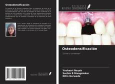 Buchcover von Osteodensificación