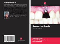 Osseodensificação kitap kapağı