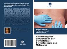 Capa do livro de Anwendung der Simulation in der Dermatologie: Dermatoskopie des Melanoms 