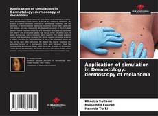 Couverture de Application of simulation in Dermatology: dermoscopy of melanoma