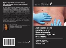 Bookcover of Aplicación de la simulación en Dermatología: dermatoscopia del melanoma