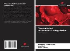 Bookcover of Disseminated intravascular coagulation
