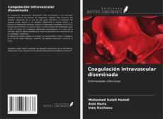 Coagulación intravascular diseminada kitap kapağı