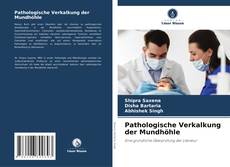 Bookcover of Pathologische Verkalkung der Mundhöhle