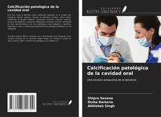 Capa do livro de Calcificación patológica de la cavidad oral 