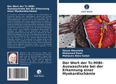 Bookcover of Der Wert der Tc-MIBI-Auswaschrate bei der Erkennung einer Myokardischämie