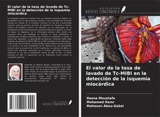 Bookcover of El valor de la tasa de lavado de Tc-MIBI en la detección de la isquemia miocárdica
