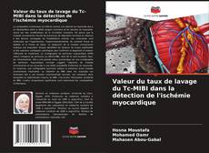 Bookcover of Valeur du taux de lavage du Tc-MIBI dans la détection de l'ischémie myocardique