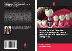 Capa do livro de Implantes inclinados: uma abordagem clínica para maxila e mandíbula atrópicas 