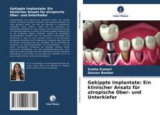 Capa do livro de Gekippte Implantate: Ein klinischer Ansatz für atropische Ober- und Unterkiefer 