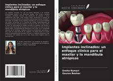 Capa do livro de Implantes inclinados: un enfoque clínico para el maxilar y la mandíbula atrópicos 